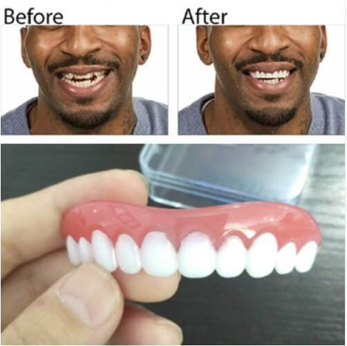 Perfect Teeth Veeners