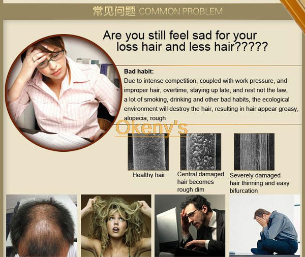 Genuine Professional Hair ginger Shampoo 300ml, Hair regrowth Dense Fast, Thicker, Shampoo Anti Hair Loss Product