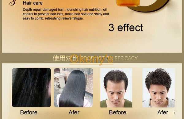 Genuine Professional Hair ginger Shampoo 300ml, Hair regrowth Dense Fast, Thicker, Shampoo Anti Hair Loss Product