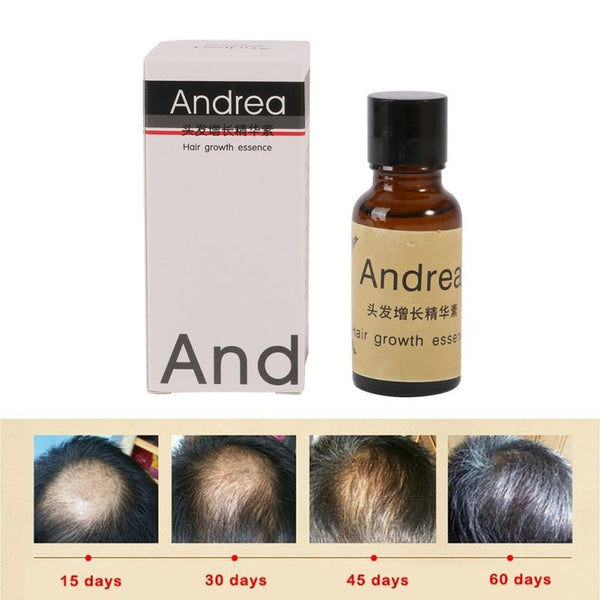 Hot Fast Sunburst Andrea Fast Hair Growth Pilatory Essence Human Hair Oil Baldness Anti Hair Loss Invalid Refund Alopecia